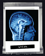 Brain Scan1.png
